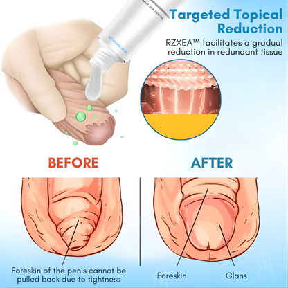 Limited Stock!!!!⚡RZXEA™ Foreskin Elasticity Gel: Restore Your Edge, Restart Your Vitality.