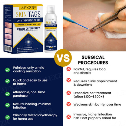 AEXZR® Cryotherapy Spray: Rapid removal of warts and calluses - visible results in 7 days ✨