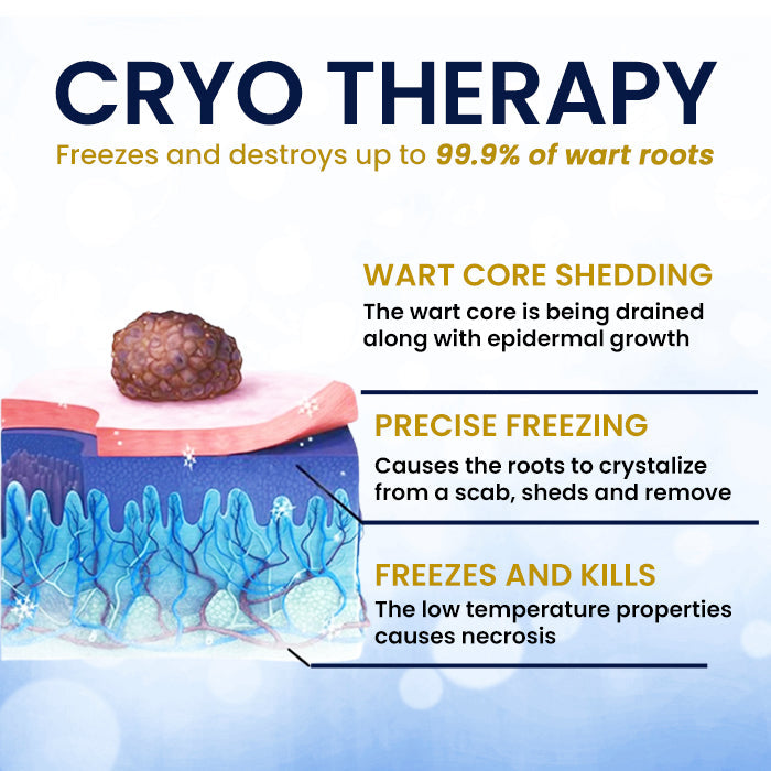 AEXZR® Cryotherapy Spray: Rapid removal of warts and calluses - visible results in 7 days ✨