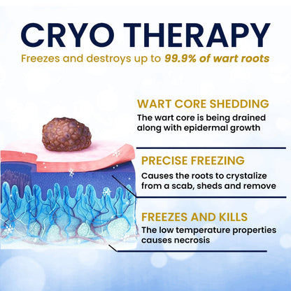 AEXZR® Cryotherapy Spray: Rapid removal of warts and calluses - visible results in 7 days ✨