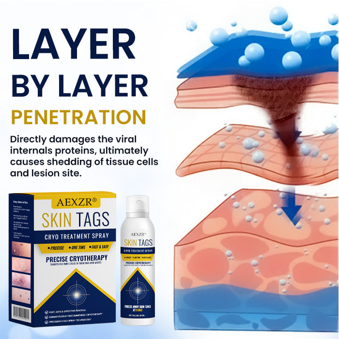 AEXZR® Cryotherapy Spray: Rapid removal of warts and calluses - visible results in 7 days ✨